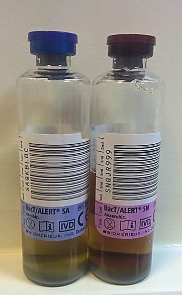 Blood Culture Bottles – Which One Goes First? A Guide to Understanding the Process